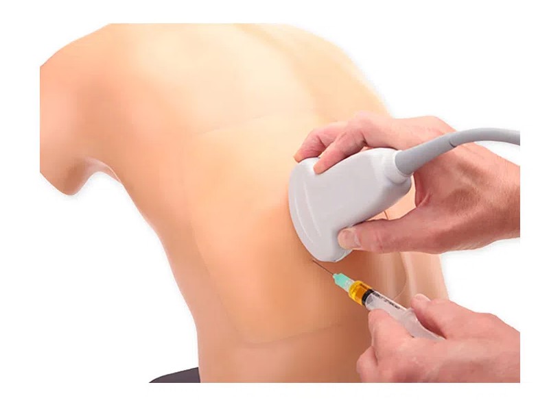 Midcapular thoracentesis ultrasound trainer