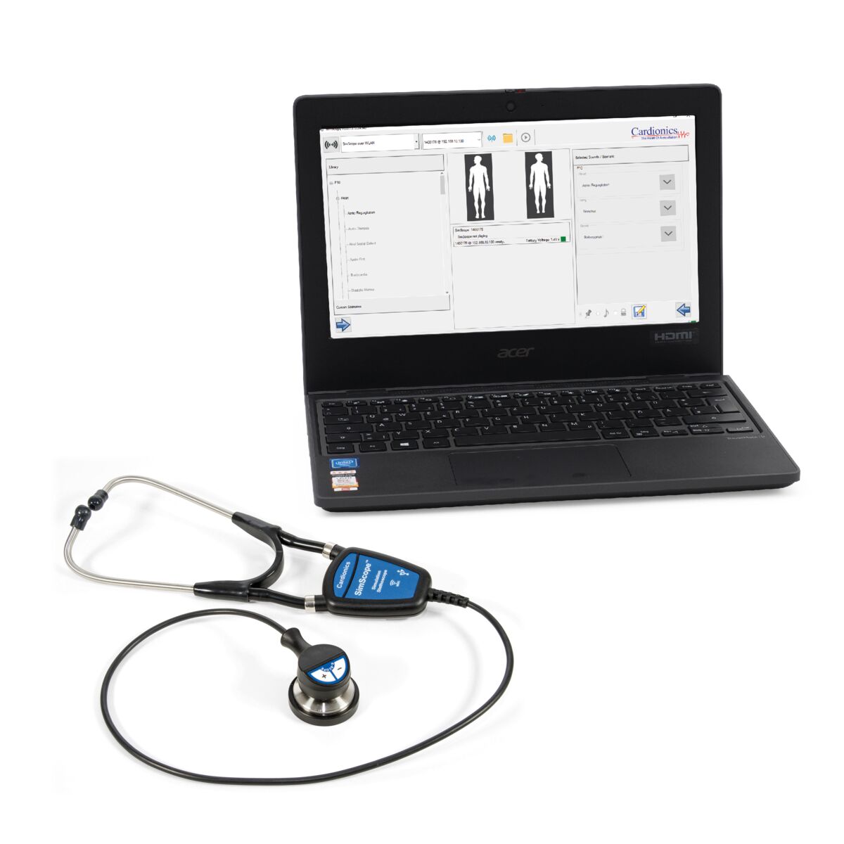 SimScope auscultation training stethoscope